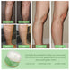 Vein Cream Red Blood Streaks Repair Earthworm Leg Bruises Bulge Relief Pain Safflower Skin care lotion Varicose Cream - Health and Wellness Innovations