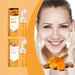Jaysuing 100ml Kojic Acid Turmeric Cleanser Anti Acne Oil Control Blackhead Remover Shrink Pores Facial Exfoliating Cleanser - Health and Wellness Innovations