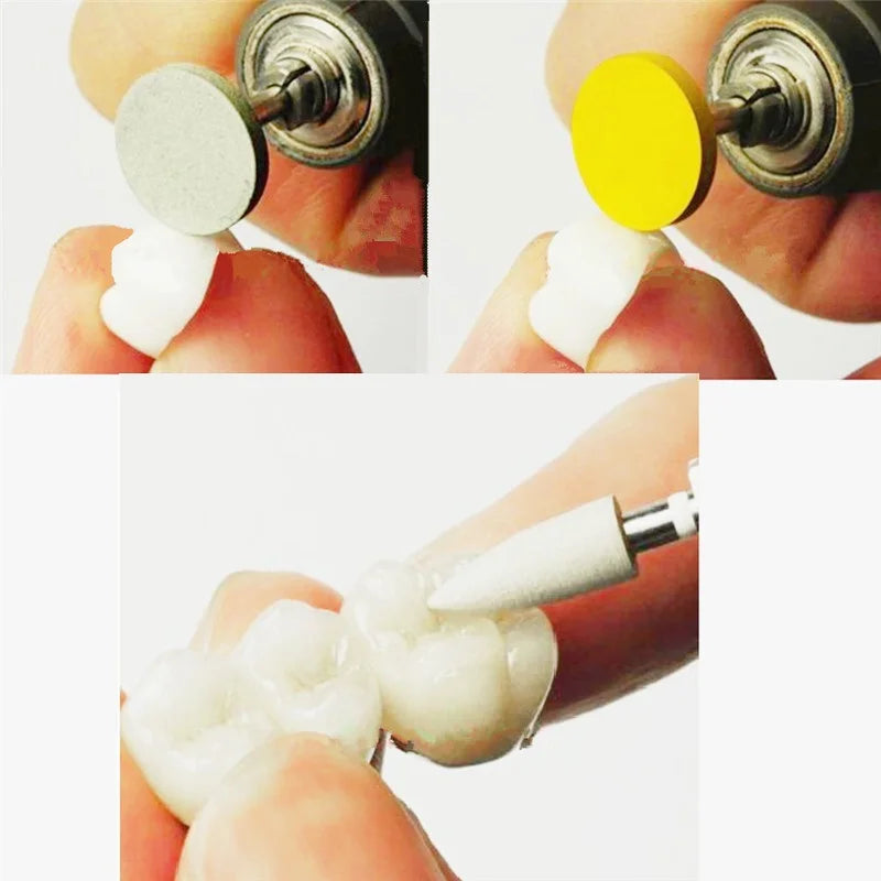Dental Silicone Grinding Head Amalgam/Metal Polisher For Low-Speed Handpiece Contra angle Composite Teeth Polishing RA Stone - Health and Wellness Innovations