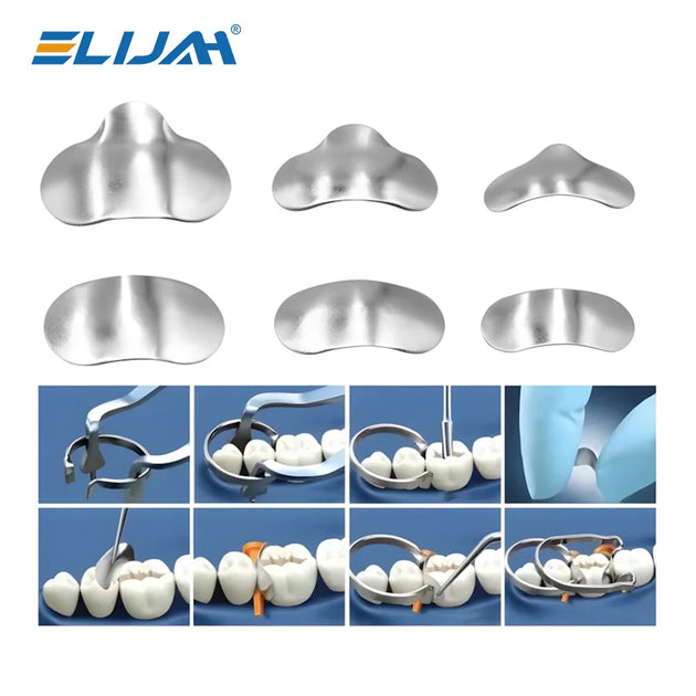 Dental Sectional Contoured Metal Matrices Matrix with Springclip No.1.330 Band Resin Clamping/Seperating Ring Dentist Tools - Health and Wellness Innovations