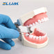 Dental Sectional Contoured Metal Matrices Matrix with Springclip No.1.330 Band Resin Clamping/Seperating Ring Dentist Tools - Health and Wellness Innovations