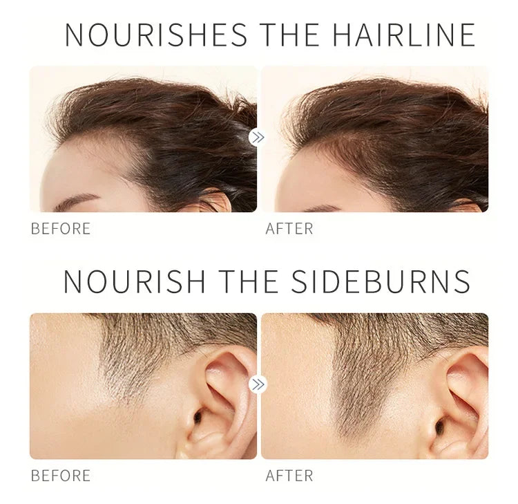 Eyebrow Growth Serum Nourishing Follicles Lashes Enhancer Thick Eyelash Nutrition Liquid Extension Intensive Lengthening 2024 - Health and Wellness Innovations