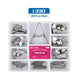 Dental Sectional Contoured Metal Matrices Matrix with Springclip No.1.330 Band Resin Clamping/Seperating Ring Dentist Tools - Health and Wellness Innovations