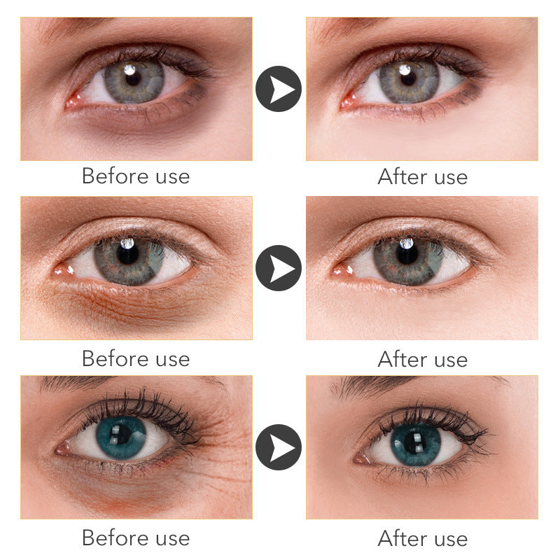 Beauty Eye Cream30mlwish Women's Skin Care Products - Health and Wellness Innovations